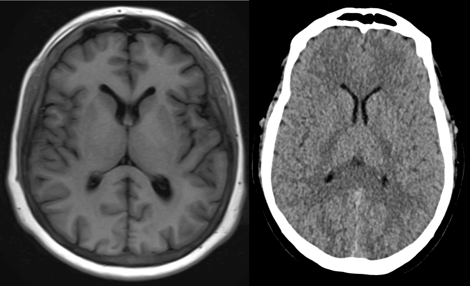 Mediphany   How to read an MRI or CT scan